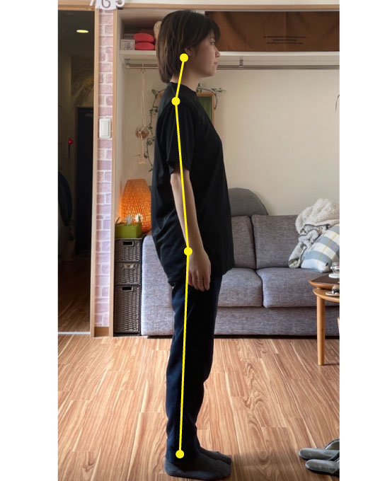 反り腰姿勢の施術後の姿勢写真